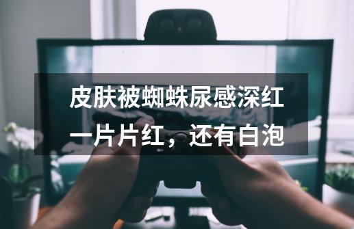 皮肤被蜘蛛尿感深红一片片红，还有白泡-第1张-游戏信息-龙启网